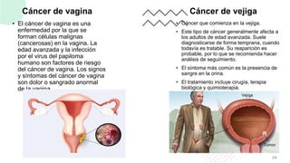 Cáncer de vagina
• El cáncer de vagina es una
enfermedad por la que se
forman células malignas
(cancerosas) en la vagina. La
edad avanzada y la infección
por el virus del papiloma
humano son factores de riesgo
del cáncer de vagina. Los signos
y síntomas del cáncer de vagina
son dolor o sangrado anormal
de la vagina.
Cáncer de vejiga
• Cáncer que comienza en la vejiga.
• Este tipo de cáncer generalmente afecta a
los adultos de edad avanzada. Suele
diagnosticarse de forma temprana, cuando
todavía es tratable. Su reaparición es
probable, por lo que se recomienda hacer
análisis de seguimiento.
• El síntoma más común es la presencia de
sangre en la orina.
• El tratamiento incluye cirugía, terapia
biológica y quimioterapia.
24
 