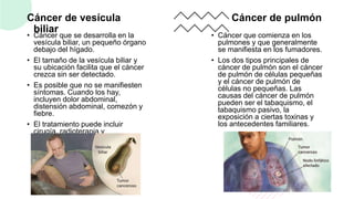 Cáncer de vesícula
biliar
• Cáncer que se desarrolla en la
vesícula biliar, un pequeño órgano
debajo del hígado.
• El tamaño de la vesícula biliar y
su ubicación facilita que el cáncer
crezca sin ser detectado.
• Es posible que no se manifiesten
síntomas. Cuando los hay,
incluyen dolor abdominal,
distensión abdominal, comezón y
fiebre.
• El tratamiento puede incluir
cirugía, radioterapia y
quimioterapia.
Cáncer de pulmón
• Cáncer que comienza en los
pulmones y que generalmente
se manifiesta en los fumadores.
• Los dos tipos principales de
cáncer de pulmón son el cáncer
de pulmón de células pequeñas
y el cáncer de pulmón de
células no pequeñas. Las
causas del cáncer de pulmón
pueden ser el tabaquismo, el
tabaquismo pasivo, la
exposición a ciertas toxinas y
los antecedentes familiares.
9
 