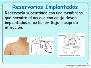 Reservorios Implantados
Reservorio subcutáneo con una membrana
que permite el acceso con aguja desde
implantados el exterior. Bajo riesgo de
infección.
 