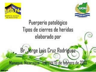 Puerperio patológico
        Tipos de cierres de heridas
               elaborado por

      Br. Jorge Luis Cruz Rodríguez

Managua, Nicaragua viernes 15 de febrero de 2013
 