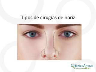Tipos de cirugías de nariz
 