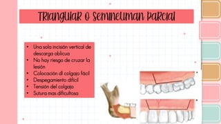 Triangular o semineuman parcial
• Una sola incisión vertical de
descarga oblicua
• No hay riesgo de cruzar la
lesión
• Colocación dl colgajo fácil
• Despegamiento difícil
• Tensión del colgajo
• Sutura mas dificultosa
 