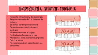 Trapezoidal o Neuman completo
• Horizontal intrasulcural y dos descargas
• Relajante realizada de 1 a 2 dientes de
distancia
• Se realiza para exposición amplia
• Excelente acceso a todo el campo
quirúrgico
• No existe tensión en el colgajo
• Facilita la visualización de la raíz
• Alteraciones en las inserciones gingivales
• Difícil de suturar
• No recomendado en pacientes con enf.
periodontal
 