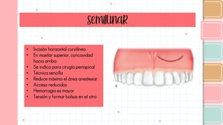 Semilunar
• Incisión horizontal curvilínea
• En maxilar superior, concavidad
hacia arriba
• Se indica para cirugía periapical
• Técnica sencilla
• Reduce máximo el área anestesiar
• Acceso reducidos
• Hemorragia es mayor
• Tensión y formar bolsas en el otro
 