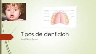 Tipos de denticion
Ana Milena Henao
 