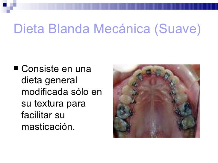 La dieta blanda - Dieta Blanda: Menú, Recetas y Alimentos La dieta blanda - Dieta Blanda: Menú, Recetas y Alimentos