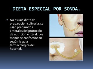 DIETA ESPECIAL POR SONDA.
 No es una dieta de
preparación culinaria, se
usan preparados
enterales del protocolo
de nutrición enteral. Los
menús se confeccionan
según la guía
farmacológica del
hospital.
 