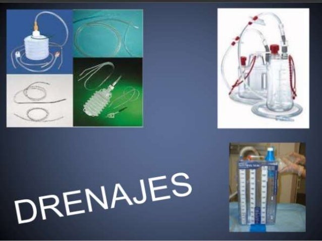 Tipos de drenajes quirurgicos pdf