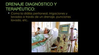DRENAJE DIAGNÓSTICO Y
TERAPÉUTICO:
 Como la diálisis peritoneal, irrigaciones y
lavados a través de un drenaje, punciones
lavado, etc.
 