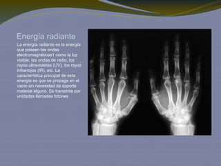 Energía radiante
La energía radiante es la energía
que poseen las ondas
electromagnéticas1 como la luz
visible, las ondas de radio, los
rayos ultravioletas (UV), los rayos
infrarrojos (IR), etc. La
característica principal de esta
energía es que se propaga en el
vacío sin necesidad de soporte
material alguno. Se transmite por
unidades llamadas fotones
 