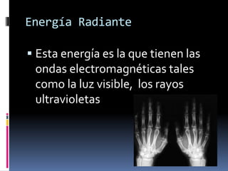 Energía Radiante
 Esta energía es la que tienen las
ondas electromagnéticas tales
como la luz visible, los rayos
ultravioletas
 