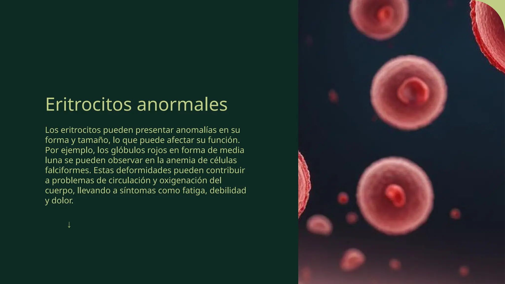 Eritrocitos anormales
Los eritrocitos pueden presentar anomalías en su
forma y tamaño, lo que puede afectar su función.
Por ejemplo, los glóbulos rojos en forma de media
luna se pueden observar en la anemia de células
falciformes. Estas deformidades pueden contribuir
a problemas de circulación y oxigenación del
cuerpo, llevando a síntomas como fatiga, debilidad
y dolor.
↓
 