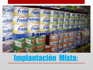 Implantación Mixta:
 