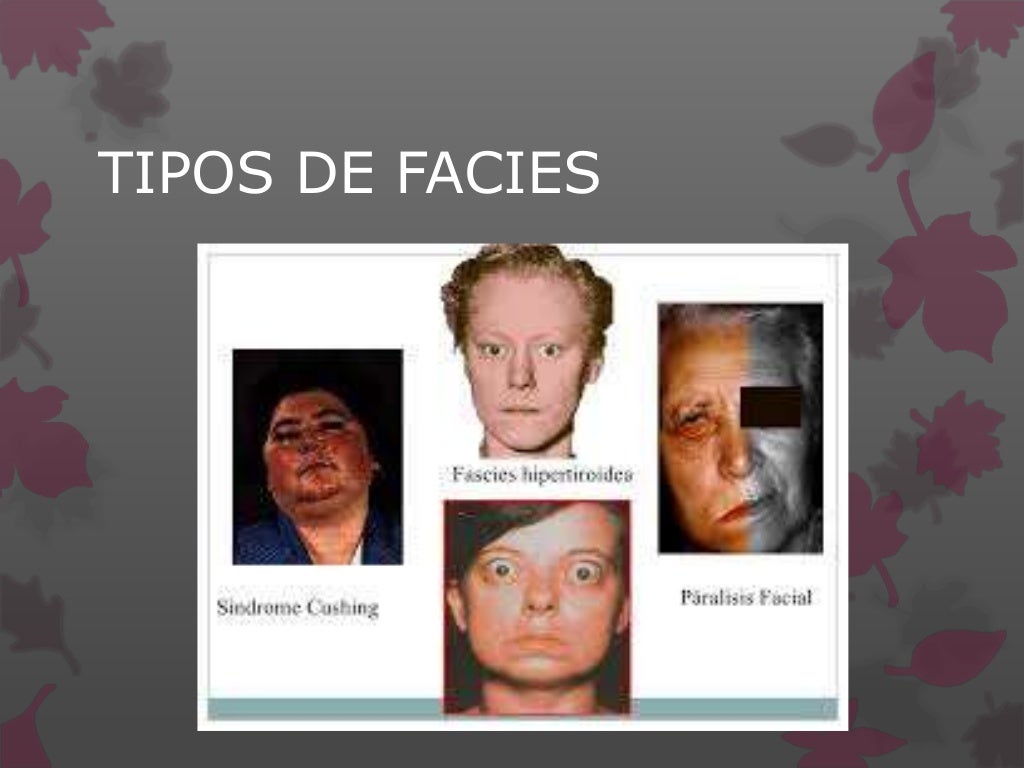 Tipos de facies