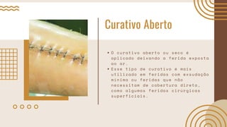 Curativo Aberto
O curativo aberto ou seco é
aplicado deixando a ferida exposta
ao ar.
Esse tipo de curativo é mais
utilizado em feridas com exsudação
mínima ou feridas que não
necessitam de cobertura direta,
como algumas feridas cirúrgicas
superficiais.
 