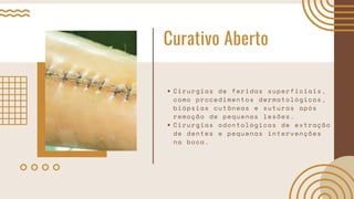 Curativo Aberto
Cirurgias de feridas superficiais,
como procedimentos dermatológicos,
biópsias cutâneas e suturas após
remoção de pequenas lesões.
Cirurgias odontológicas de extração
de dentes e pequenas intervenções
na boca.
 