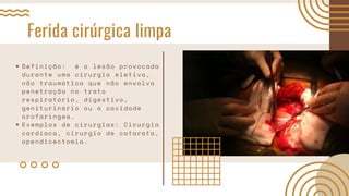 Ferida cirúrgica limpa
Definição: é a lesão provocada
durante uma cirurgia eletiva,
não traumática que não envolva
penetração no trato
respiratório, digestivo,
geniturinário ou a cavidade
orofaríngea.
Exemplos de cirurgias: Cirurgia
cardíaca, cirurgia de catarata,
apendicectomia.
 