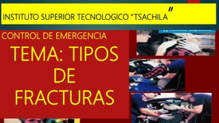 INSTITUTO SUPERIOR TECNOLOGICO “TSACHILA”
CONTROL DE EMERGENCIA
TEMA: TIPOS
DE
FRACTURAS
 