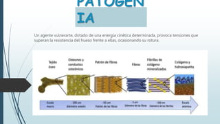 PATOGEN
IA
Un agente vulnerarte, dotado de una energía cinética determinada, provoca tensiones que
superan la resistencia del hueso frente a ellas, ocasionando su rotura.
 