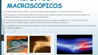 ASPECTOS
MACROSCOPICOS
 La deformidad puede indicar una fractura (separación parcial de los huesos en una articulación).
 Por lo general, la inflamación indica una fractura, pero puede necesitar varias horas para desarrollarse. La
inflamación puede ser sutil, pero rara vez está ausente.
 La hipersensibilidad acompaña a casi todas las lesiones musculo esqueléticas y en muchos pacientes la
palpación de cualquier lugar alrededor de la lesión puede causarles molestias.
 La crepitación (una característica palpable o chirrido audible producido cuando la articulación es movida) puede
ser signo de fractura.
 
