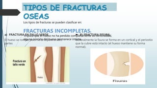 TIPOS DE FRACTURAS
OSEAS
Los tipos de fracturas se pueden clasificar en:
FRACTURAS INCOMPLETAS:
Implica que el hueso no ha perdido completamente su continuidad,
alguna porción del hueso permanece intacta.
a) FRACTURA EN TALLO VERDE
El hueso se rompe, pero no se separa en dos
partes
 B) FRACTURA FISURA
Generalmente la fisura se forma en un cortical y el periostio
que la cubre está intacto (el hueso mantiene su forma
normal).
 