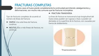 FRACTURAS COMPLETAS
En estos casos el hueso pierde completamente la continuidad permitiendo cabalgamientos y
deformaciones, son mucho más comunes que las fracturas incompletas
Tipo de fracturas completas de acuerdo al
número de líneas de fractura:
 SIMPLE: Una sola línea de fractura,
continua.
 MULTILE: Dos o más líneas de fractura, no
continua.
 FRACTURA TRANSVERSA
La línea de fractura es transversal al eje longitudinal del
hueso estas pueden ser rugosas o lisas o pueden ser
dentadas en la superficie de la fractura, son causadas por
fuerza de doblamiento
 