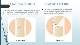 FRACTURA CERRADA FRACTURA ABIERTA
 Es una fractura que permanece encerrada dentro
de la piel y musculatura que le rodea. No existe
comunicación con el medio ambiente exterior.
 El hueso sobresale a través de la piel. Este
hecho tiene importancia por la potencial
contaminación de la fractura.
 