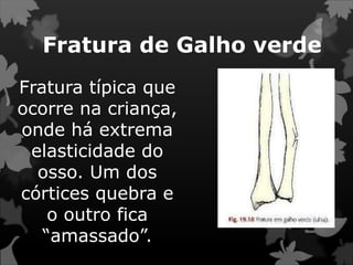 Fratura de Galho verde
Fratura típica que
ocorre na criança,
onde há extrema
elasticidade do
osso. Um dos
córtices quebra e
o outro fica
“amassado”.
 