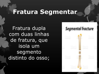 Fratura Segmentar
Fratura dupla
com duas linhas
de fratura, que
isola um
segmento
distinto do osso;
 