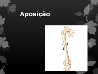 Aposição
 
