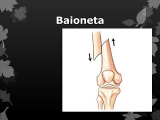 Baioneta
 