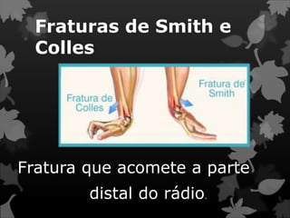 Fraturas de Smith e
Colles
Fratura que acomete a parte
distal do rádio.
 