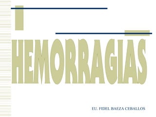 HEMORRAGIAS EU. FIDEL BAEZA CEBALLOS 