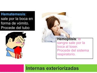 Hematemesis:
sale por la boca en
forma de vómito.
Procede del tubo
digestivo.
Hemoptisis: la
sangre sale por la
boca al toser.
Procede del sistema
respiratorio.

Internas exteriorizadas

 