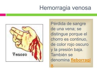 Hemorragia venosa
Pérdida de sangre
de una vena; se
distingue porque el
chorro es continuo,
de color rojo oscuro
y la presión baja.
También se
denomina fleborragi
a.

 