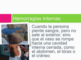 Hemorragias Internas
Cuando la persona
pierde sangre, pero no
sale al exterior, sino
que el vaso se rompe
hacia una cavidad
interna cerrada, como
el abdomen, el tórax o
el cráneo

 