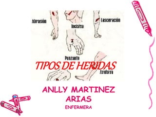TIPOS DE HERIDAS 
ANLLY MARTINEZ 
ARIAS 
ENFERMERA 
 