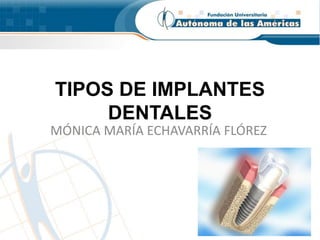 TIPOS DE IMPLANTES
DENTALES
MÓNICA MARÍA ECHAVARRÍA FLÓREZ
 