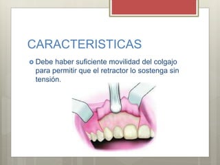 CARACTERISTICAS
 Debe haber suficiente movilidad del colgajo
para permitir que el retractor lo sostenga sin
tensión.
 