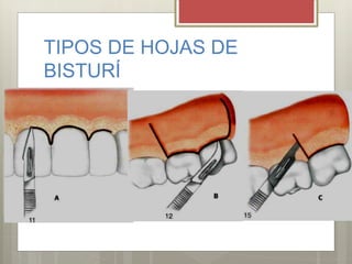 TIPOS DE HOJAS DE
BISTURÍ
 