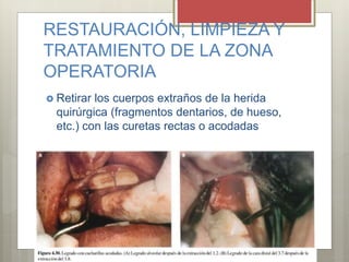 RESTAURACIÓN, LIMPIEZA Y
TRATAMIENTO DE LA ZONA
OPERATORIA
 Retirar los cuerpos extraños de la herida
quirúrgica (fragmentos dentarios, de hueso,
etc.) con las curetas rectas o acodadas
 