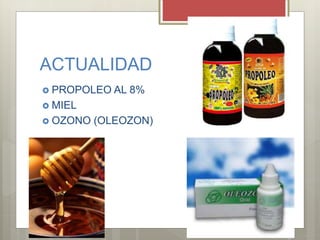 ACTUALIDAD
 PROPOLEO AL 8%
 MIEL
 OZONO (OLEOZON)
 