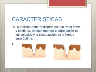 CARACTERISTICAS
 La incisión debe realizarse con un trazo firme
y continuo, de esta manera la adaptación de
los colgajos y la cicatrización de la herida
será óptima.
 