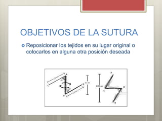 OBJETIVOS DE LA SUTURA
 Reposicionar los tejidos en su lugar original o
colocarlos en alguna otra posición deseada
 