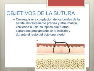 OBJETIVOS DE LA SUTURA
 Conseguir una coaptación de los bordes de la
herida absolutamente precisa y atraumática,
volviendo a unir los tejidos que fueron
separados previamente en la incisión y
durante el resto del acto operatorio.
 