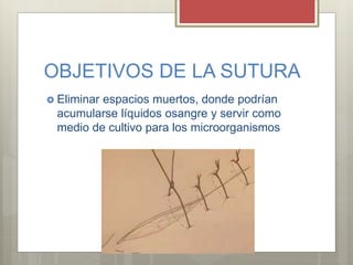 OBJETIVOS DE LA SUTURA
 Eliminar espacios muertos, donde podrían
acumularse líquidos osangre y servir como
medio de cultivo para los microorganismos
 