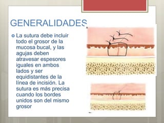 GENERALIDADES
 La sutura debe incluir
todo el grosor de la
mucosa bucal, y las
agujas deben
atravesar espesores
iguales en ambos
lados y ser
equidistantes de la
línea de incisión. La
sutura es más precisa
cuando los bordes
unidos son del mismo
grosor
 