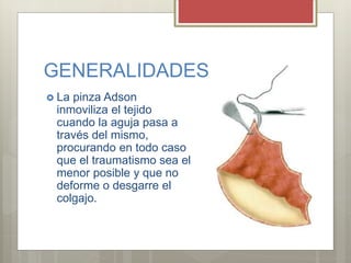 GENERALIDADES
 La pinza Adson
inmoviliza el tejido
cuando la aguja pasa a
través del mismo,
procurando en todo caso
que el traumatismo sea el
menor posible y que no
deforme o desgarre el
colgajo.
 