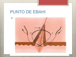 PUNTO DE EBAHI
 