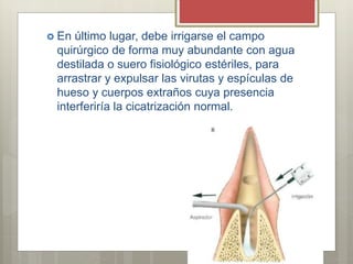GENERALIDADES
 La sutura debe incluir
todo el grosor de la
mucosa bucal, y las
agujas deben
atravesar espesores
iguales e...